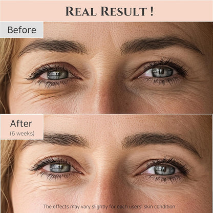 Beauty of Joseon Revive Eye Serum Ginseng + Retinal paakių serumas
