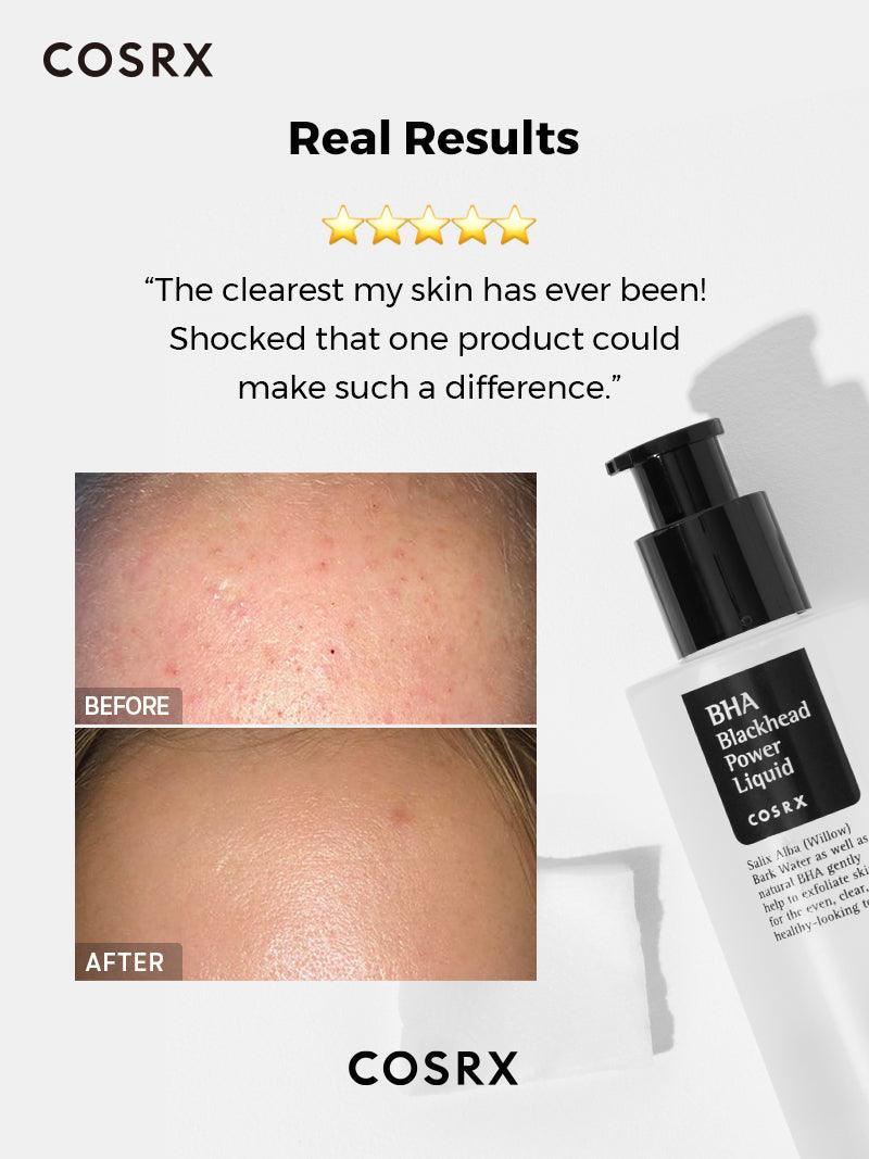 BHA BLACKHEAD POWER LIQUID - priemonė kovai su inkštirais