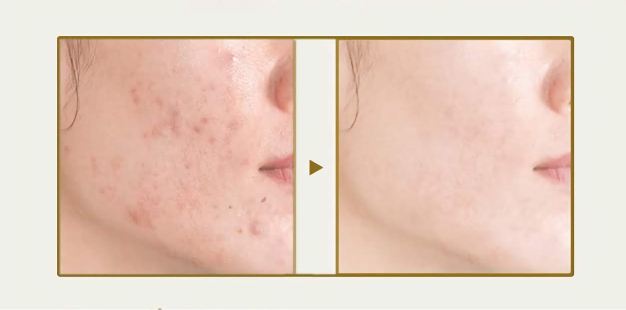 Beauty of Joseon GLOW SERUM : PROPLIS + NIACINAMIDE serumas